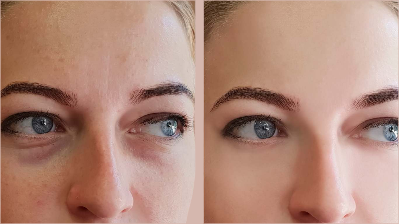 SIERO CONTORNO OCCHI - 15 ML - Oftalmologicamente Testato